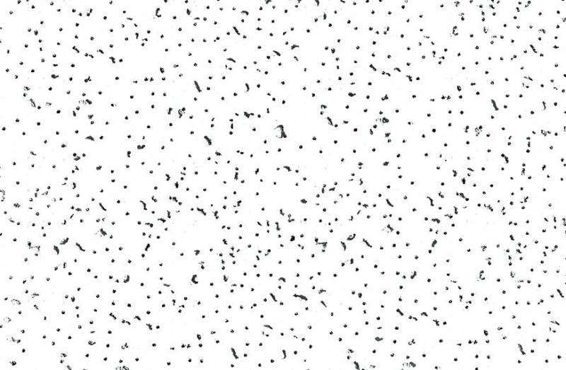 USG Radar — şəkil 2